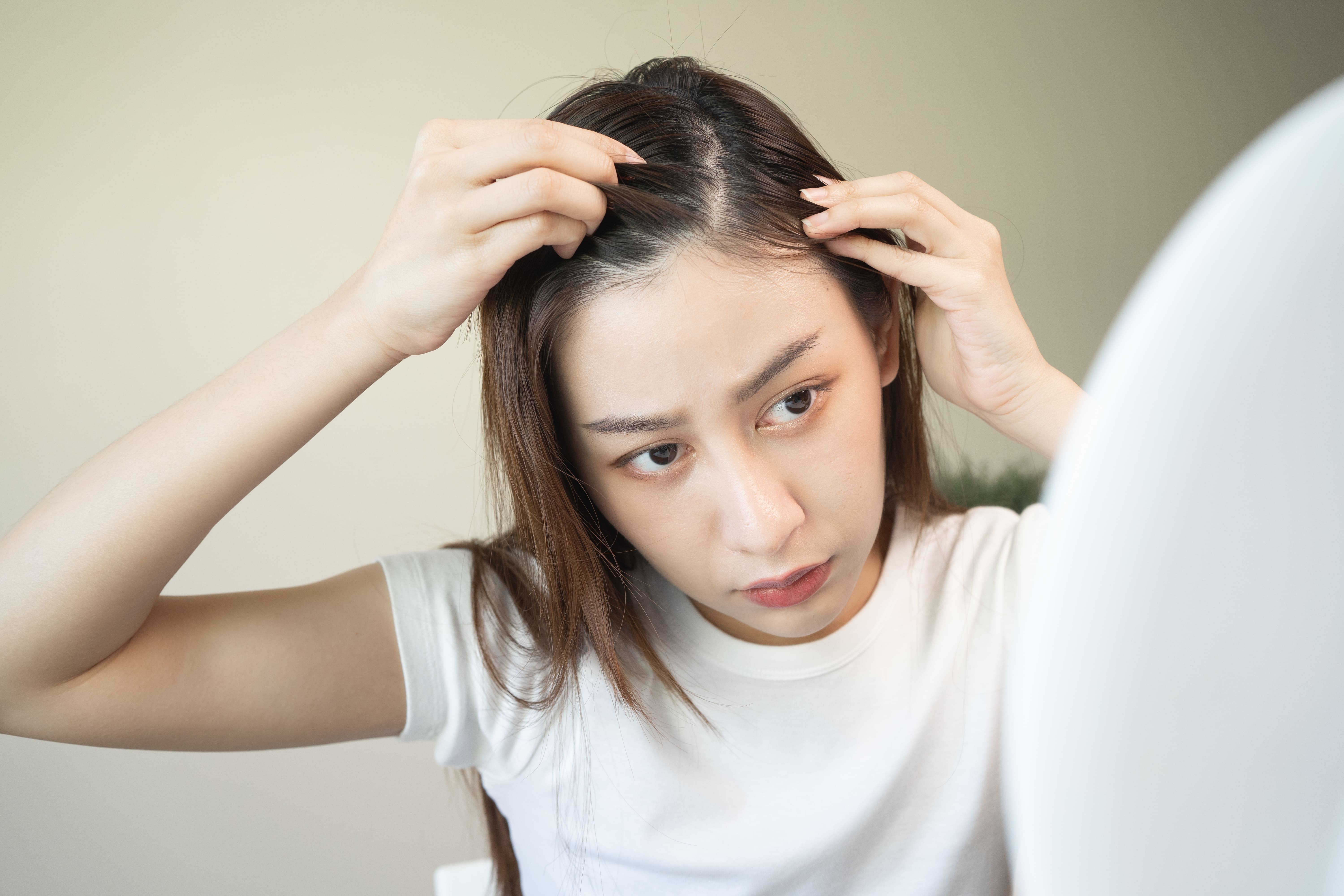 女性の薄毛の悩み