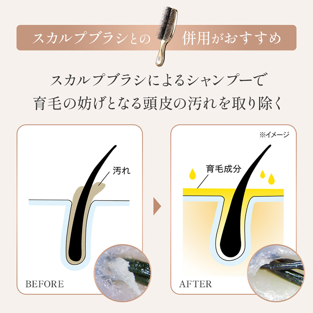 Sasso ボリュームミスト 育毛剤 150mL 医薬部外品 定期コース