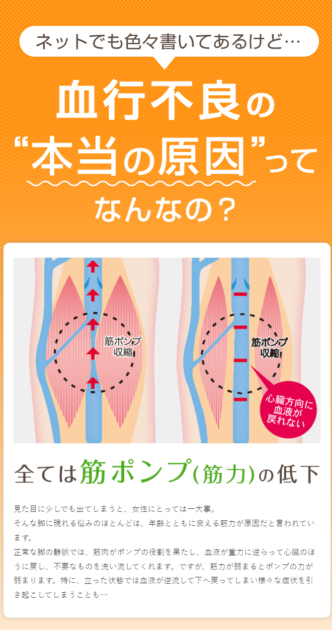【決算SALE】めぐりんぱ弾性ストッキング・ベージュ（S）☆F 