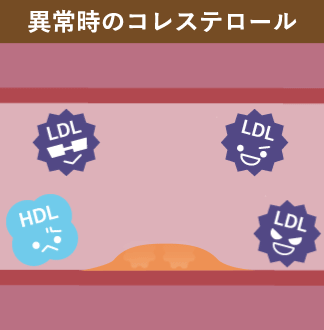 異常時のコレステロール
