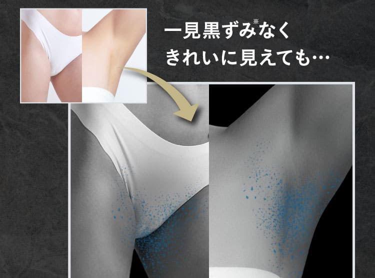 一見黒ずみのないきれいなワキでも…