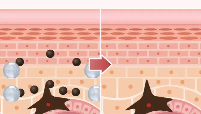 L-システインがメラニンの過剰な生成を抑制