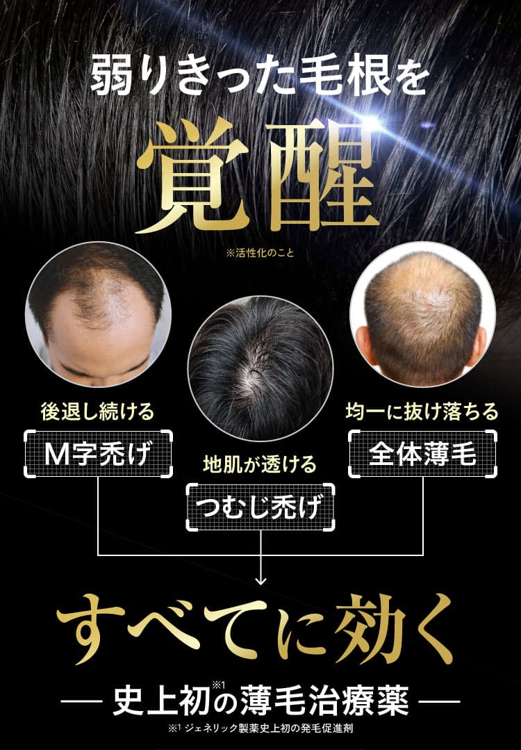 弱りきった毛根を覚醒。M字禿げ・つむじ禿げ・全体薄毛すべてに効く史上初の薄毛治療薬