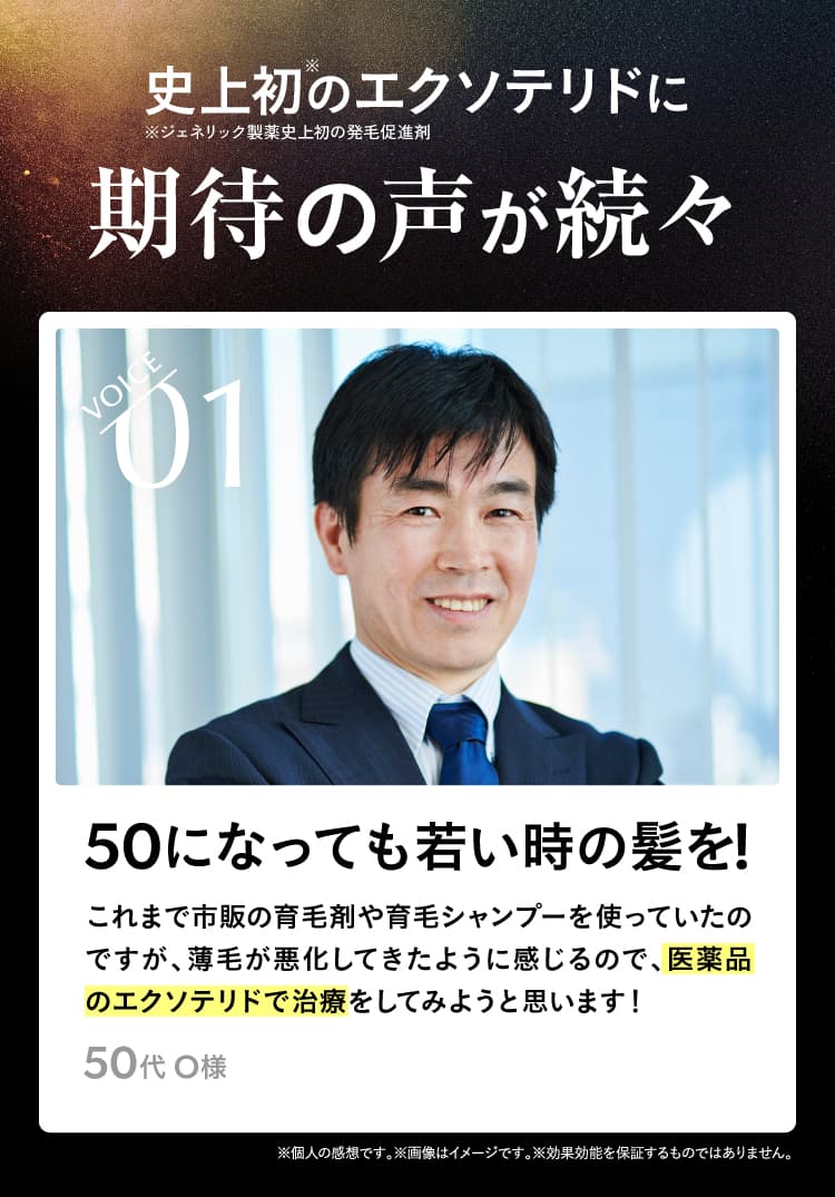 VOICE01 50になっても若い時の髪を！