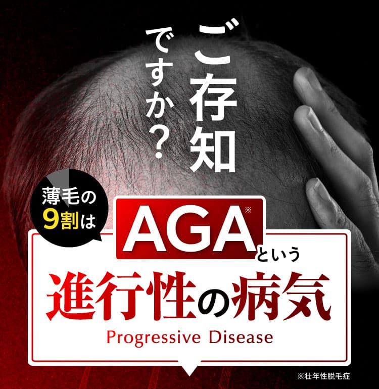 ご存知ですか？薄毛の9割はAGAという進行性の病気