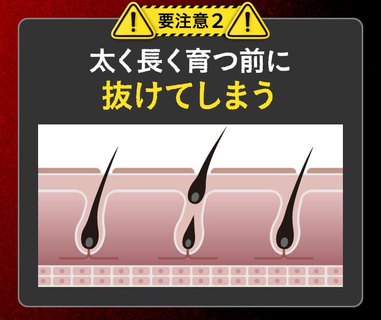 要注意2 太く長く育つ前に抜けてしまう