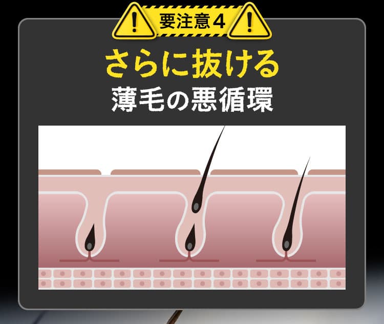 要注意4 さらに抜ける薄毛の悪循環