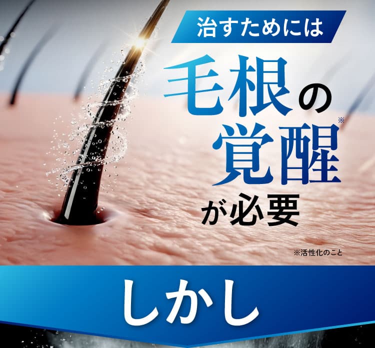 治すためには毛根の覚醒が必要。しかし
