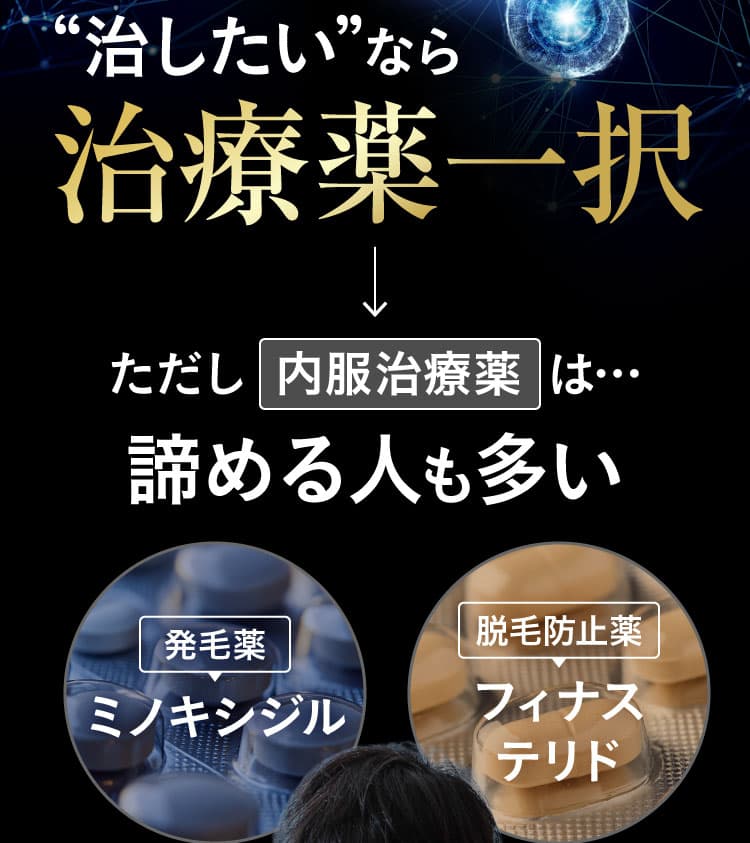治したいなら治療薬一択。ただし内服治療薬は諦める人も多い