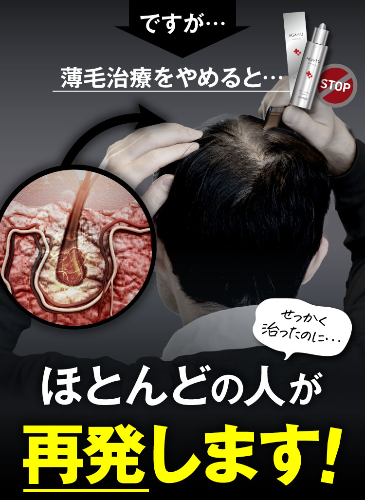 ほとんどの人が再発