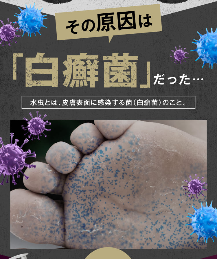 その原因は乾燥ではなく「水虫」｜カカるるん