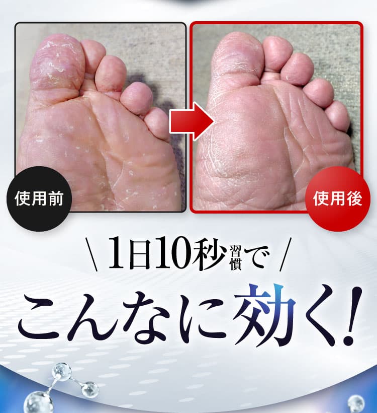 BA｜カカるるん