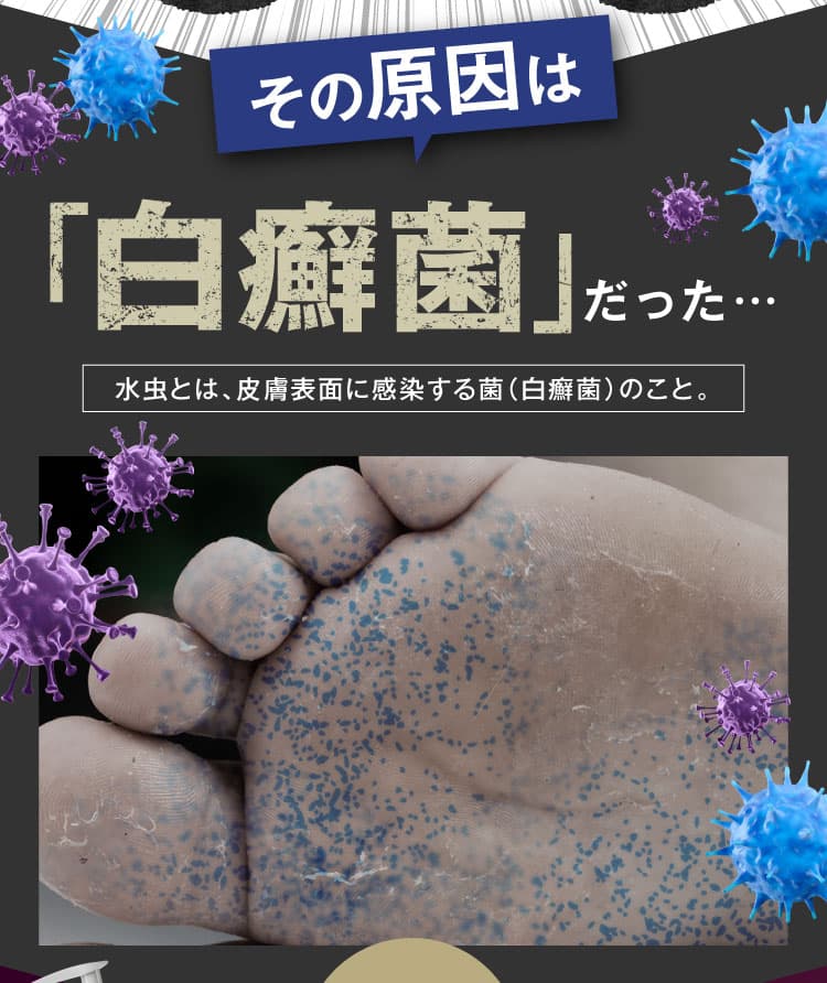 その原因は乾燥ではなく「水虫」｜カカるるん