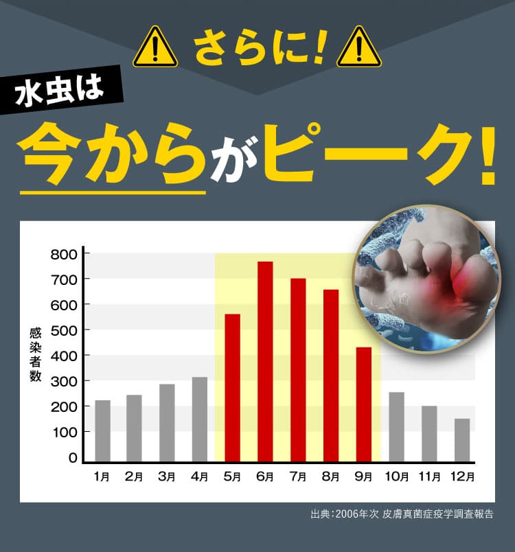 さらに水虫の感染リスクはどんどん高くなっていく｜カカるるん