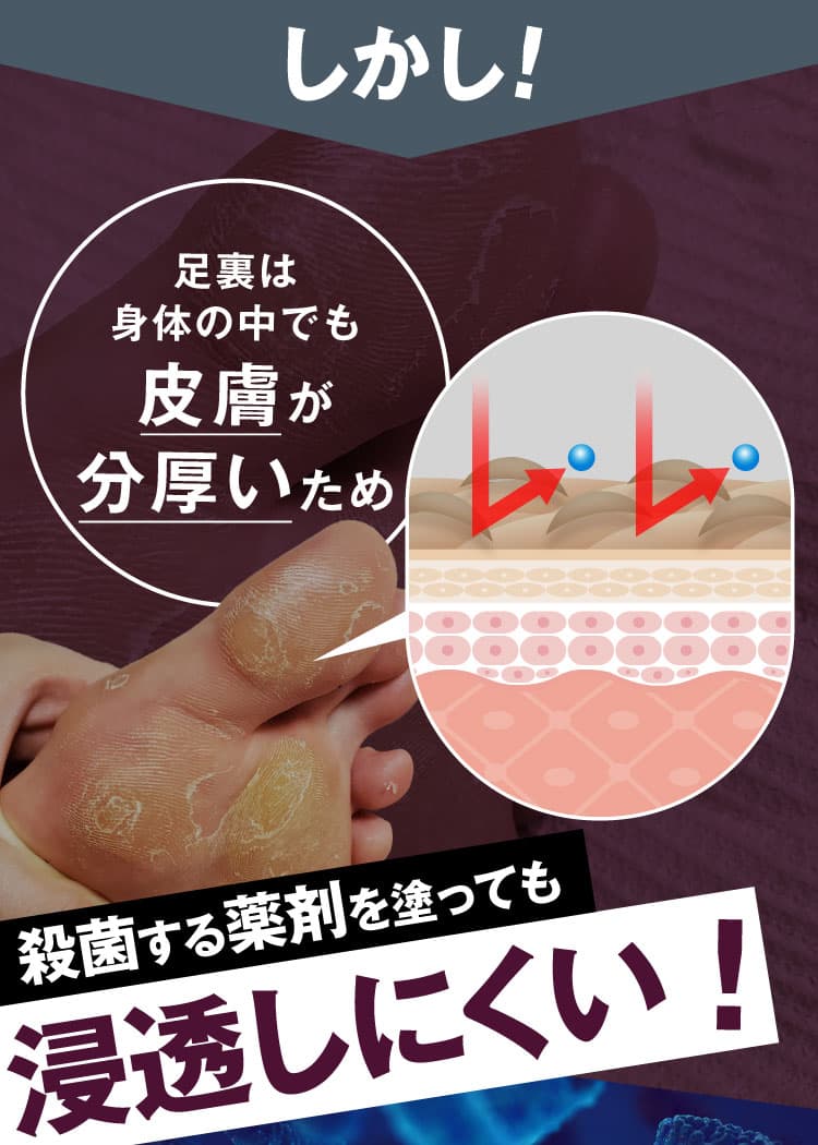 なぜ市販の保湿クリームや化粧品ではダメなの？｜カカるるん