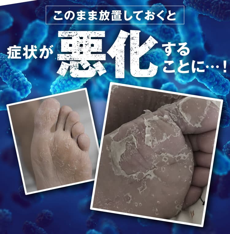 悪化することも｜カカるるん