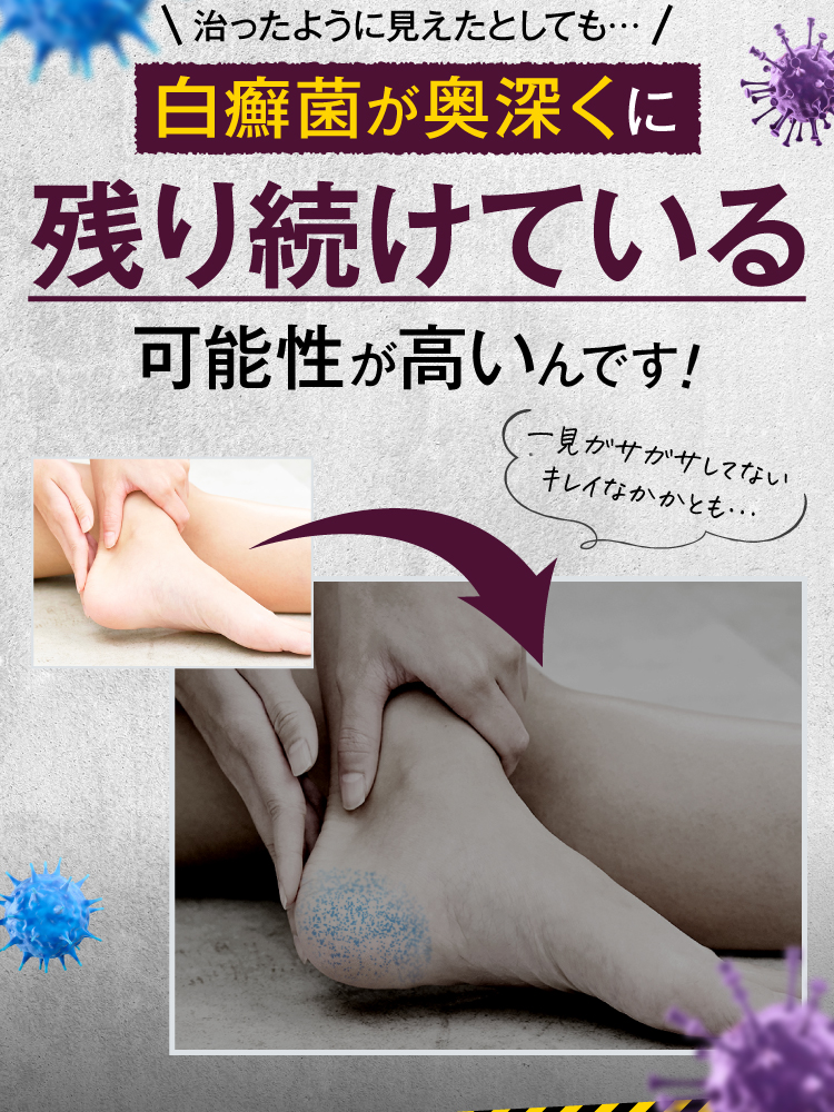 治療の最重要ポイントは皮膚のゴミを排出すること
