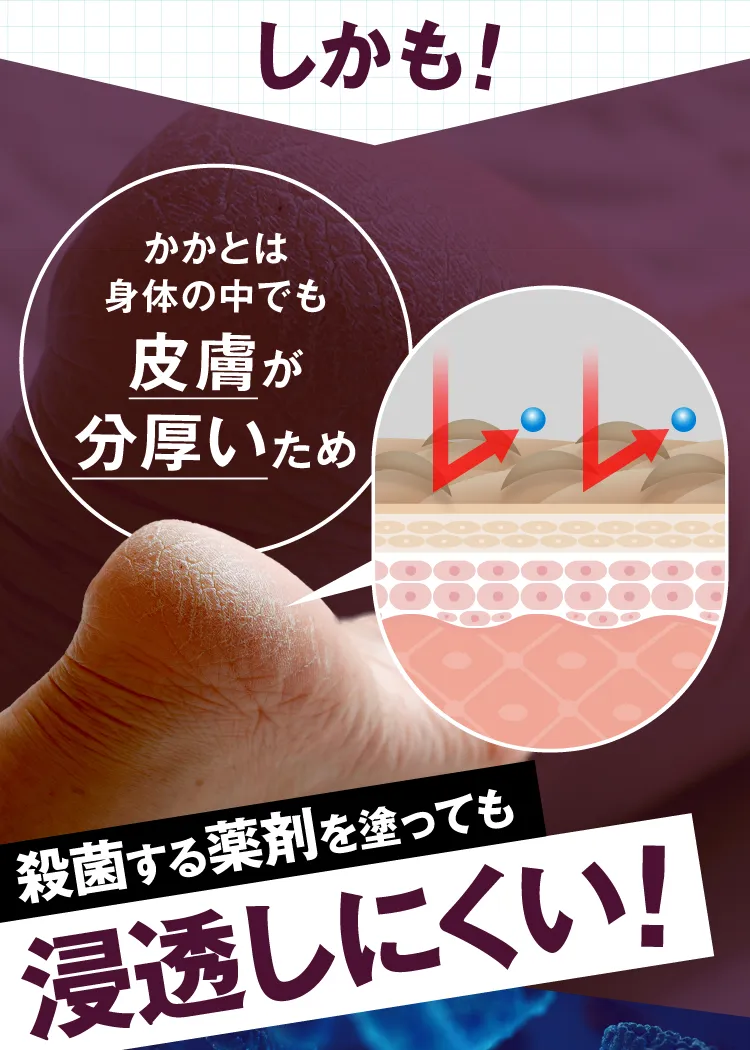有効成分が奥深くまで浸透し水虫の原因菌をくまなく殺菌｜カカるるん