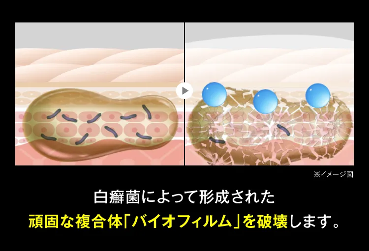 白癬菌によって形成された頑固なバイオフィルムを破壊します｜カカるるん