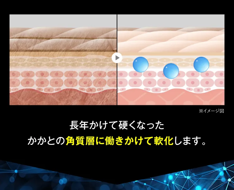 長年かけて硬くなったかかとの角質層に働きかけて軟化します｜カカるるん
