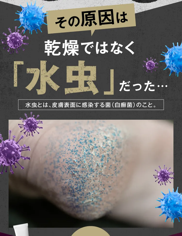 その原因は乾燥ではなく「水虫」｜カカるるん