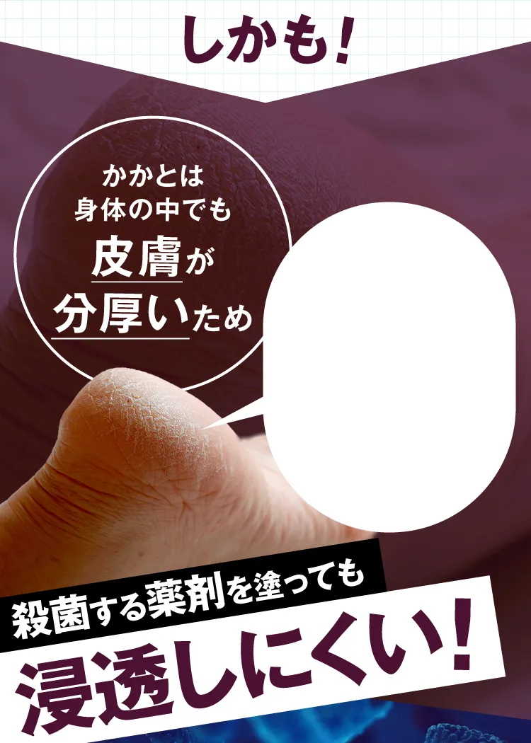 有効成分が奥深くまで浸透し水虫の原因菌をくまなく殺菌｜カカるるん