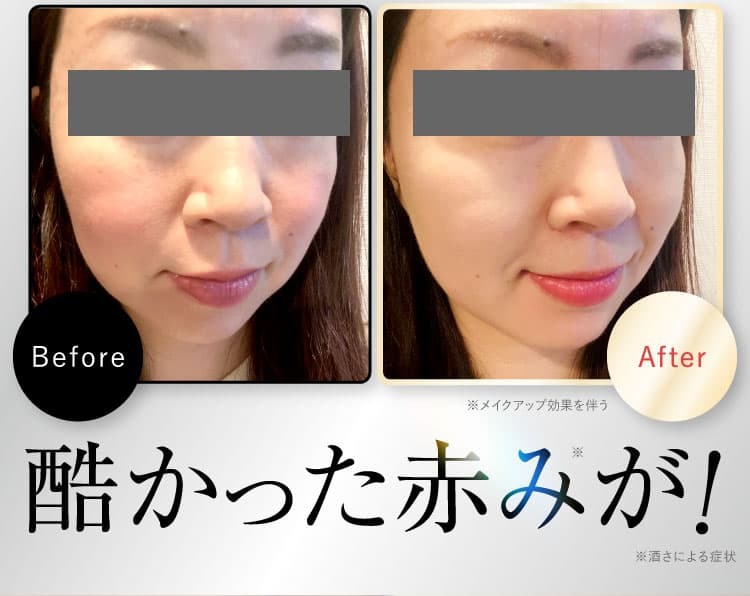 before/after