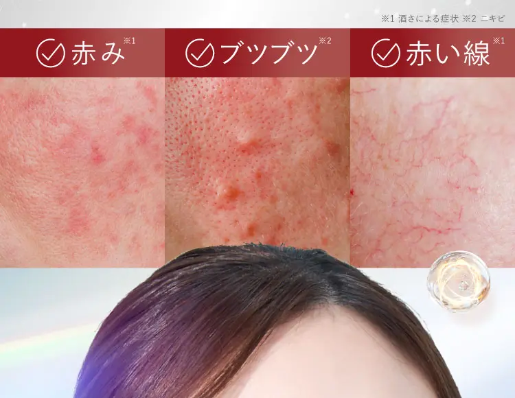 日本唯一シュサノン内服錠