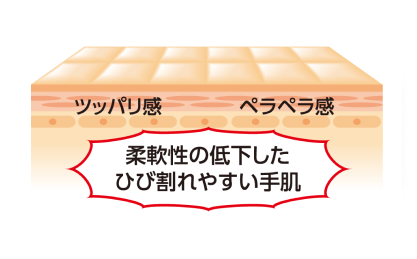 ツッパリ感・ペラペラ感、柔軟性の低下したひび割れやすい手肌