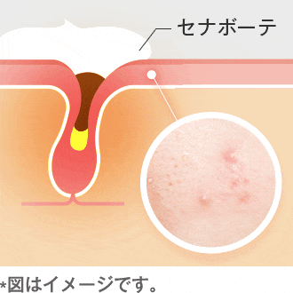 セナボーテが透明感ある肌に導きます。
