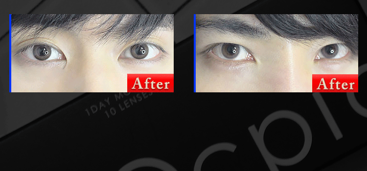 Before After Before After