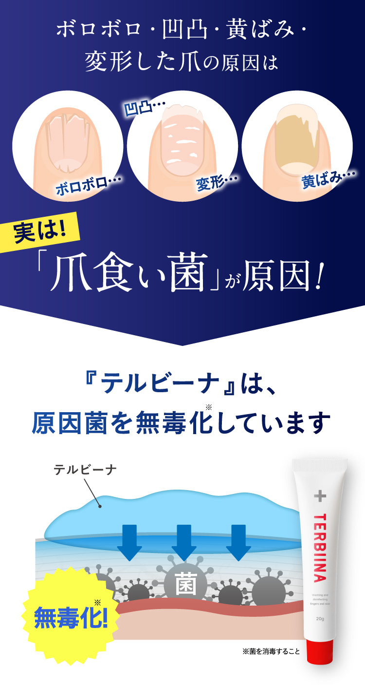 ボロボロ・凹凸・黄ばみ・変形した爪の原因は実は！「爪食い菌」が原因！『テルビーナ』は、原因菌を無毒化※しています。※菌を消毒すること