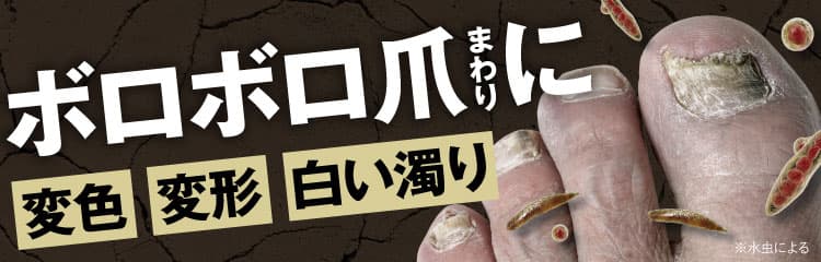 三ツ星クリアナチュラルで爪まわりを治療！