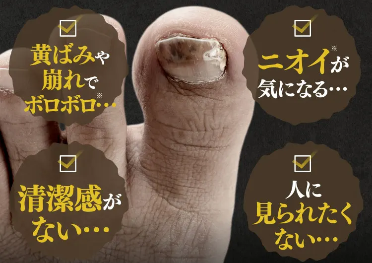 黄ばみや崩れでボロボロ