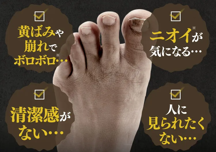 黄ばみや崩れでボロボロ