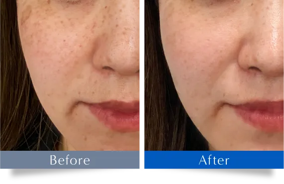 Before After 比較画像