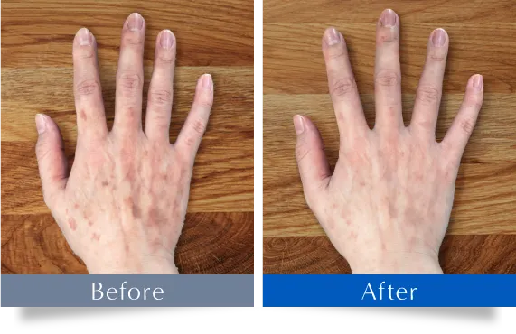 Before After 比較画像