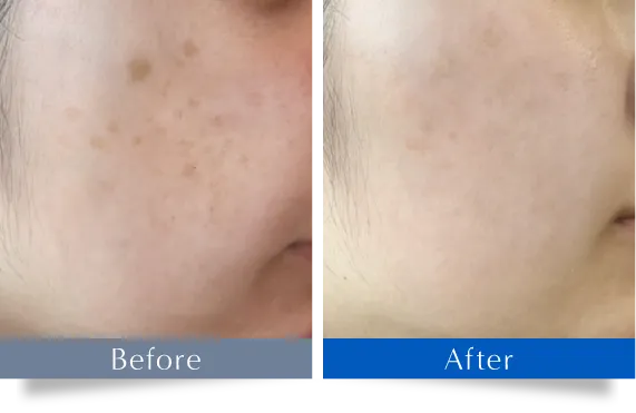 Before After 比較画像