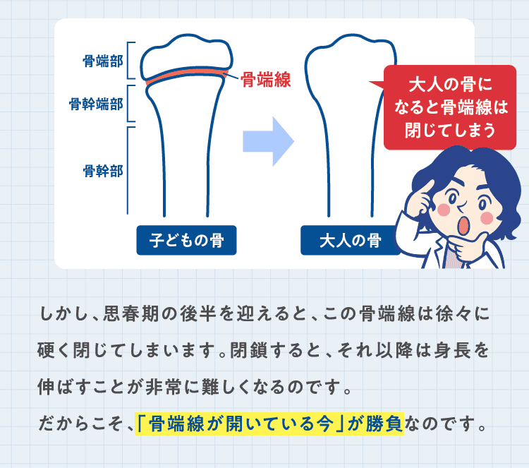 大人の骨になると骨端線は閉じてしまう　しかし、思春期の後半を迎えると、この骨端線は徐々に硬く閉じてしまいます。閉鎖すると、それ以降は身長を伸ばすことが非常に難しくなるのです。　だからこそ、「骨端線が開いている今」が勝負なのです。