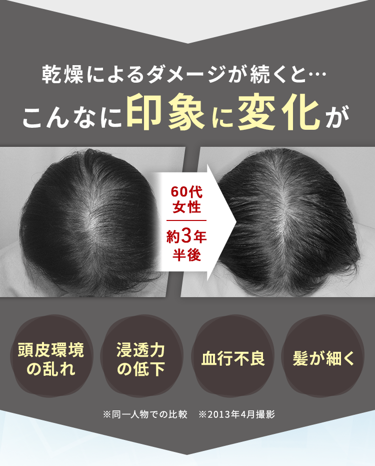 乾燥によるダメージが続くと…こんなに印象に変化が