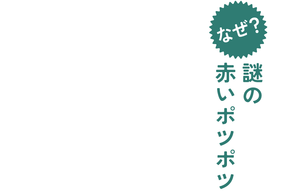 なぜ？謎の赤い湿疹