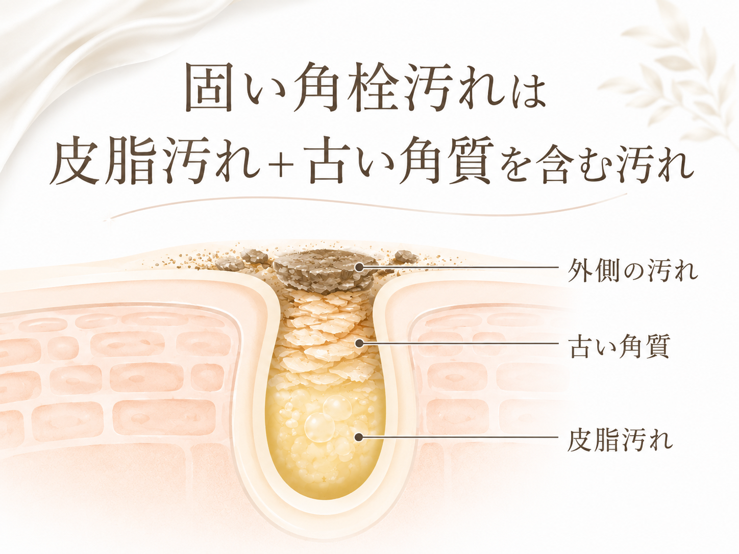 固い角栓汚れは皮脂汚れと古い角質を含む汚れで考える図