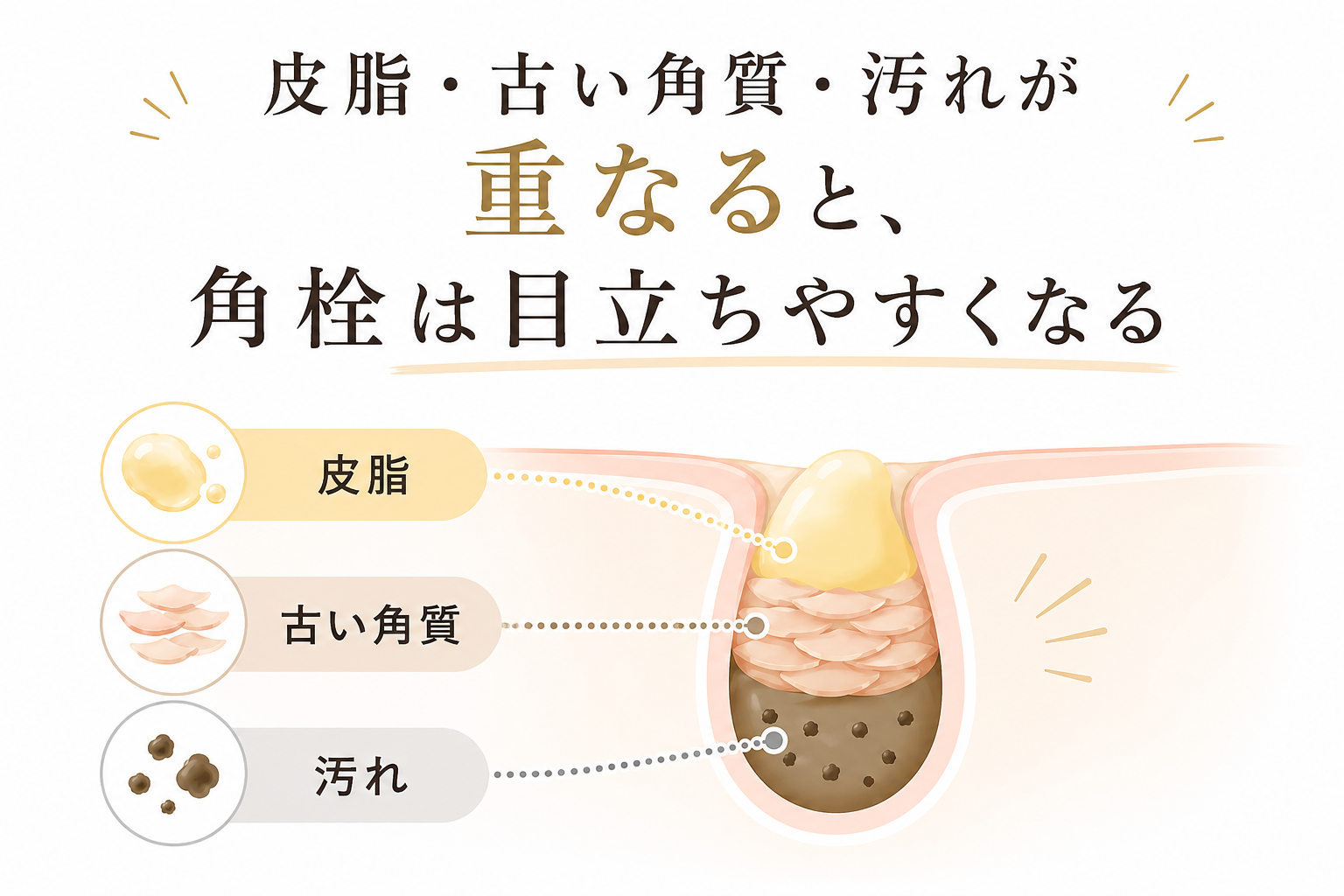 皮脂や古い角質が重なり角栓が目立つ仕組みの図解
