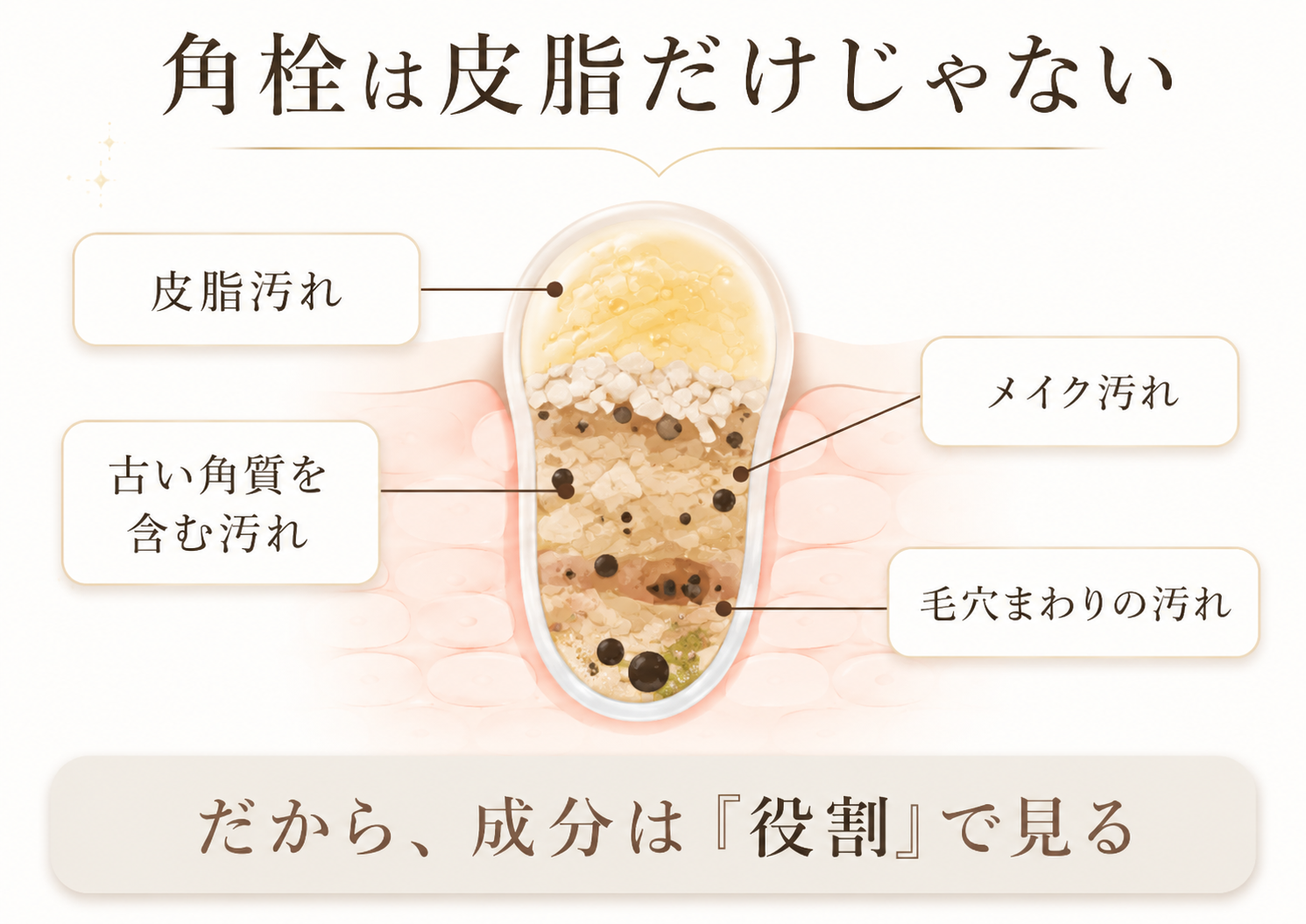 角栓の構造を示す図解イメージ