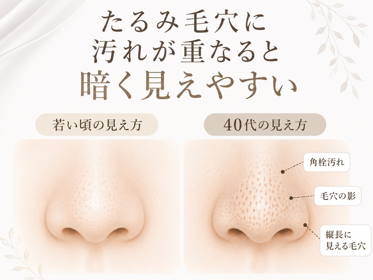 たるみ毛穴に角栓汚れや影が重なることで黒ずみが目立つ仕組み図