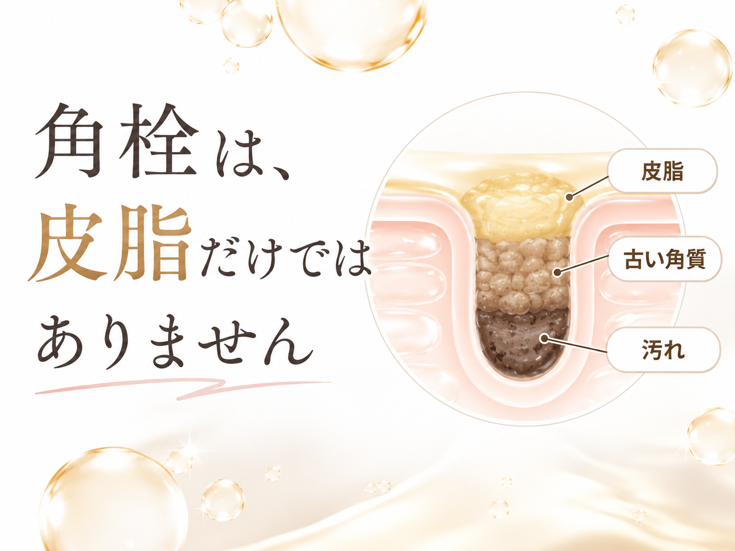 皮脂と古い角質が混ざった角栓の構造図