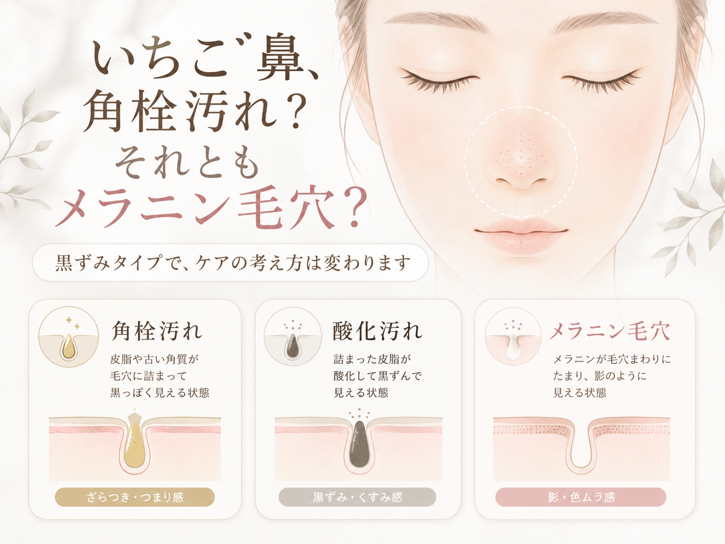 メラニン毛穴について解説する関連記事イメージ
