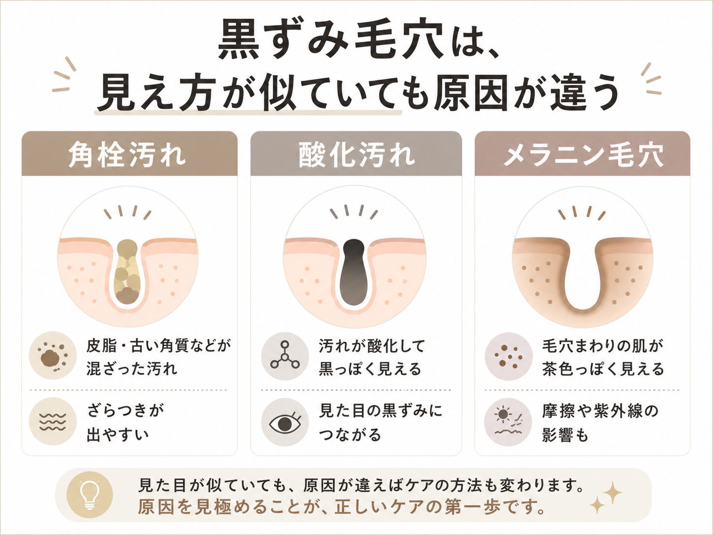 角栓汚れ・酸化汚れ・メラニン毛穴のタイプ別比較図