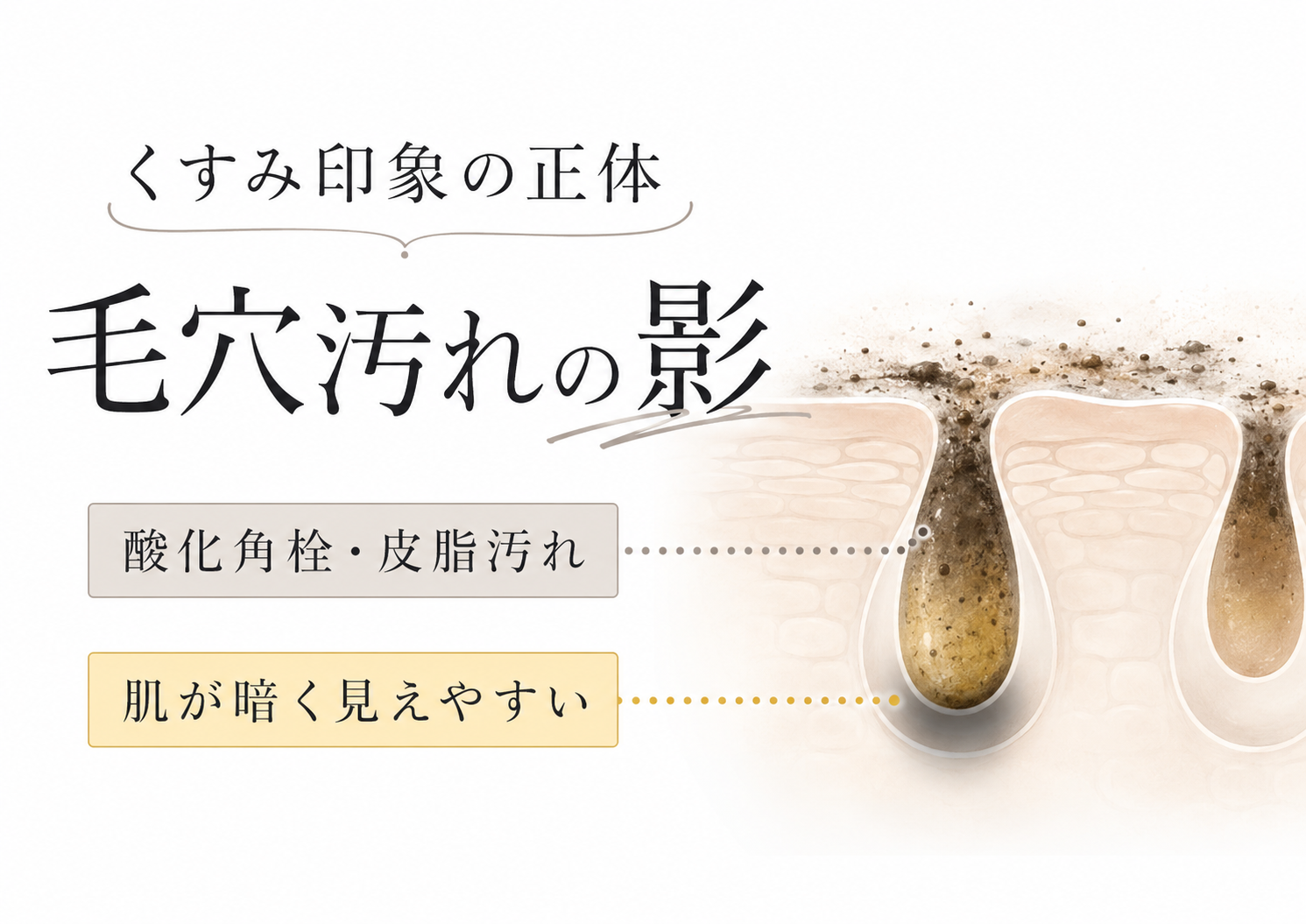 くすみ印象と毛穴汚れの影の関係を説明する図