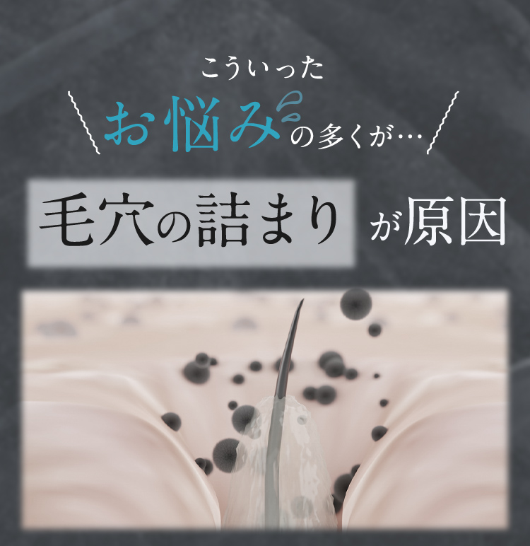 こういったお悩みの多くが… 毛穴の詰まりが原因